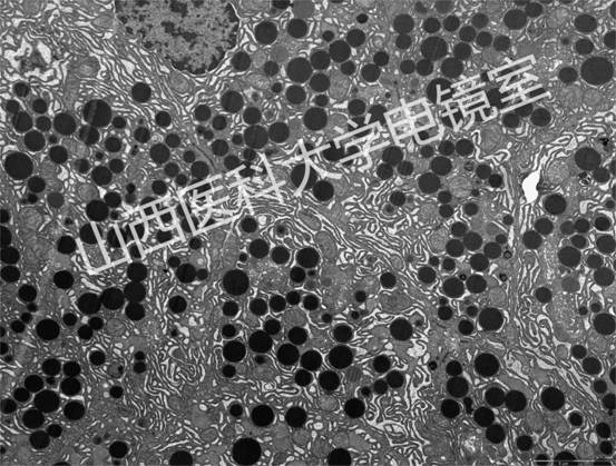 胰腺內(nèi)分泌細(xì)胞